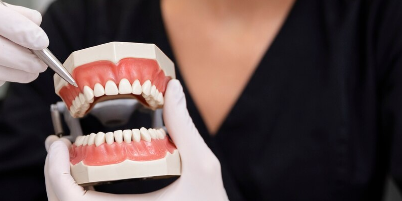 Full Mouth Dental Implants