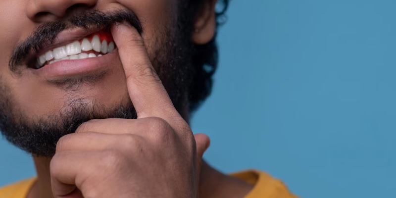 Gum Disease Treatment