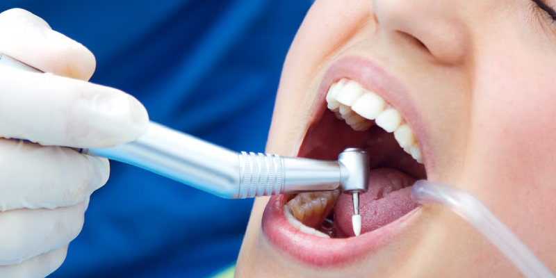 Painless Tooth Removal