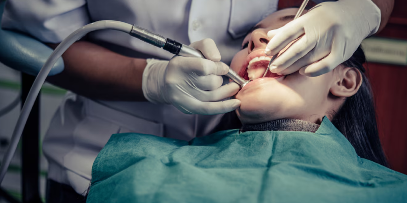 Wisdom Tooth Removal